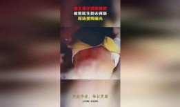 缅北医生爆料视频播放,揭秘真实战地医疗现状